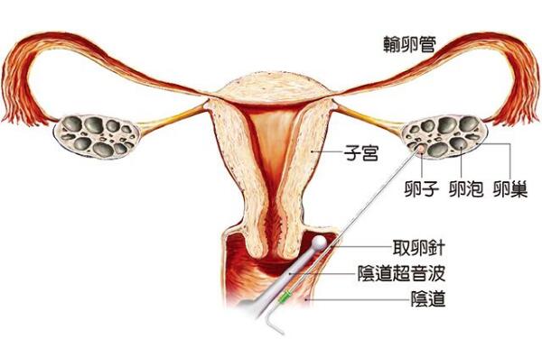 专业的河北石家庄求子助孕多少钱便宜多少